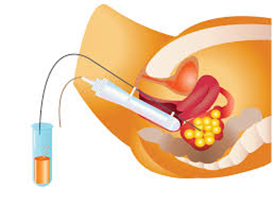 Aşılama Yöntemleri Nelerdir?
